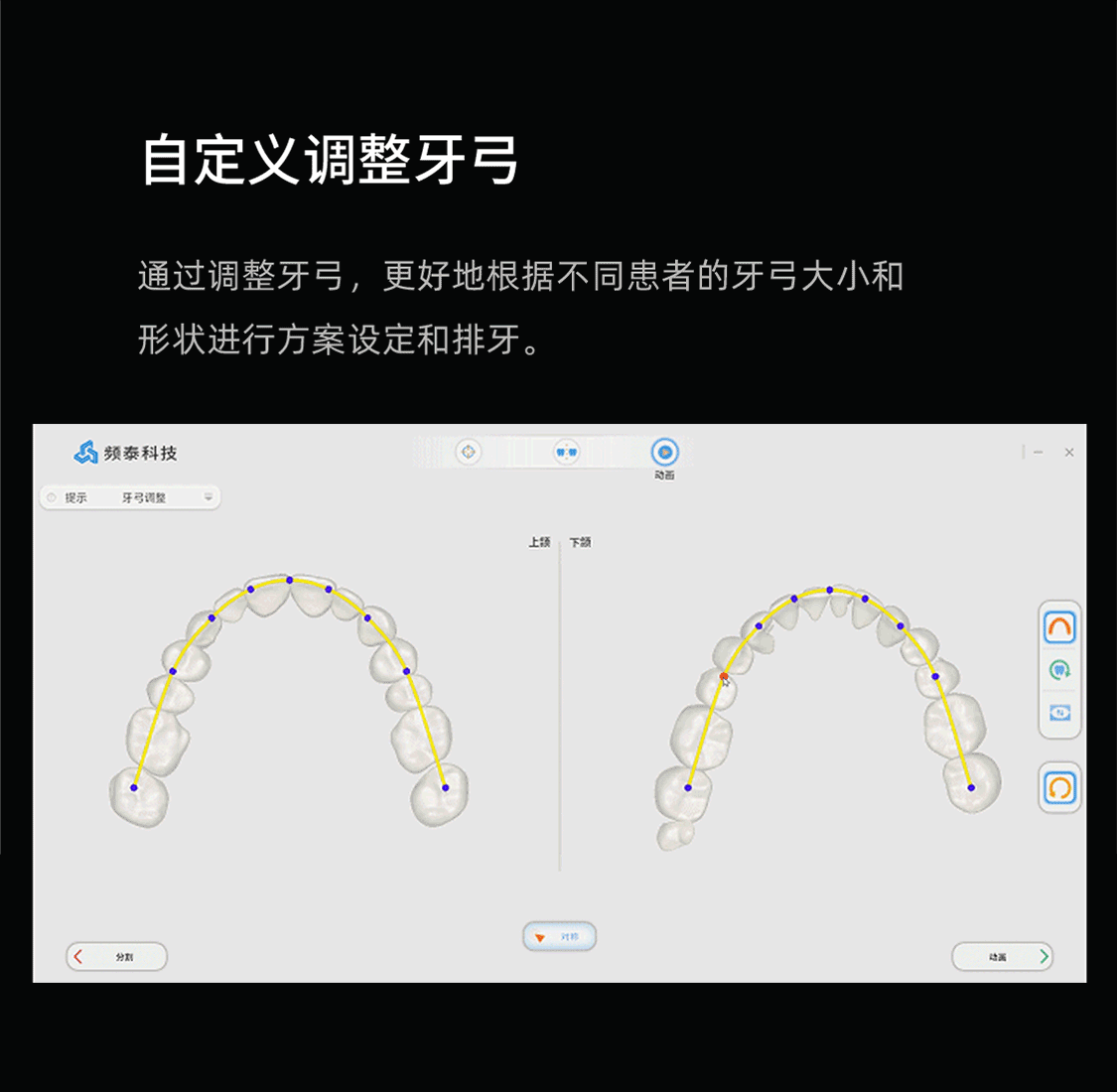 牙弓調(diào)整-2023871340391.gif